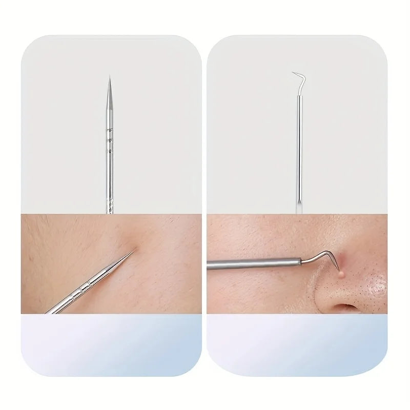 Professional Acne Removal Kit