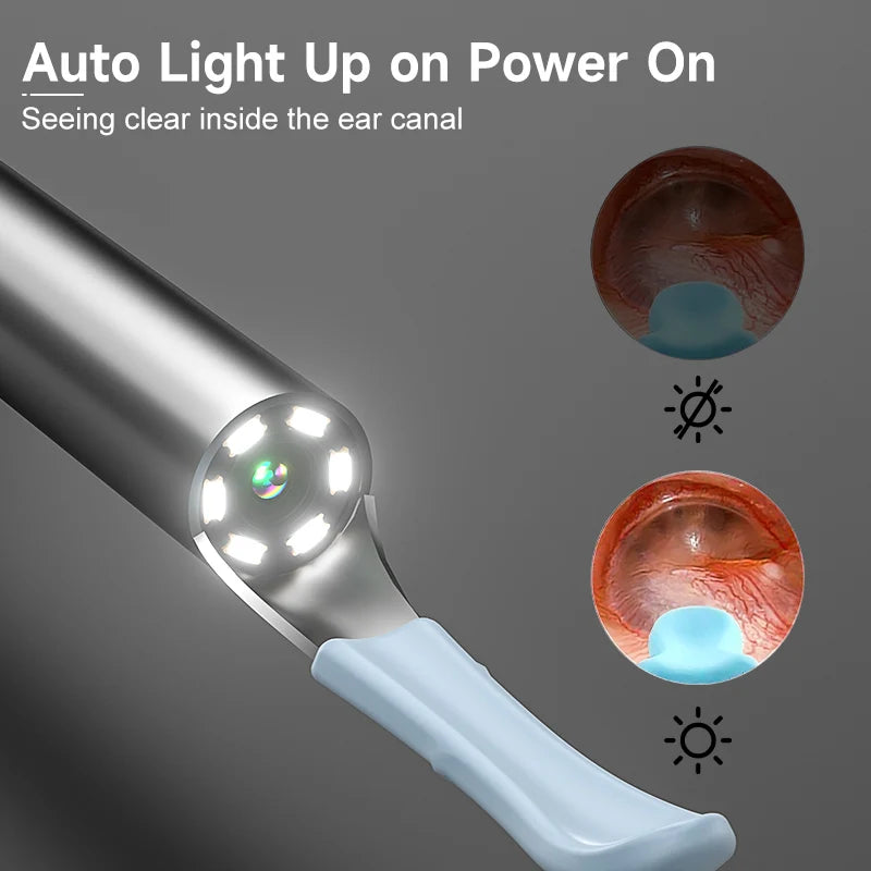 Smart Visual Ear Cleaner