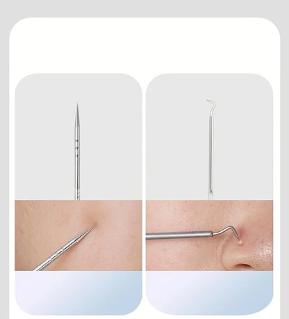 Professional Acne Removal Kit